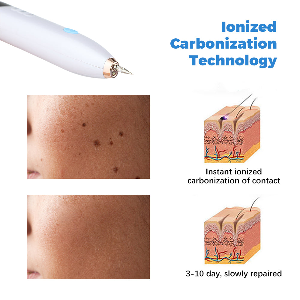 Women Freckle Removal Laser Machine