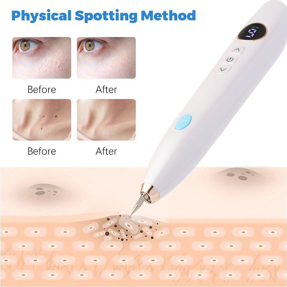 Women Freckle Removal Laser Machine